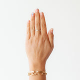 Sea Urchin Stacking Band